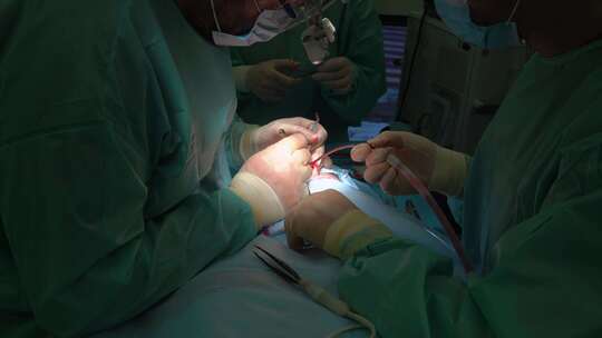 手术 医生 外科医生 手术室视频素材模板下载