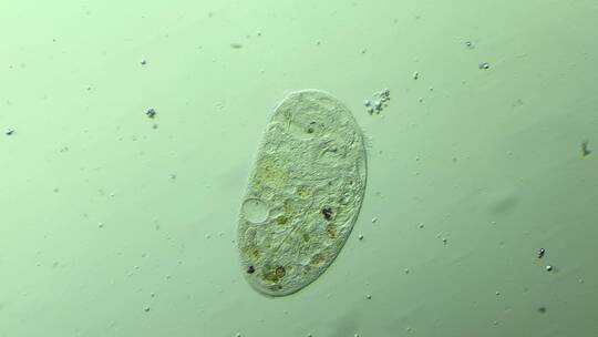 显微镜下的真实微生物 喇叭虫5