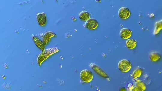 显微镜下放大200倍的微生物眼虫裸藻
