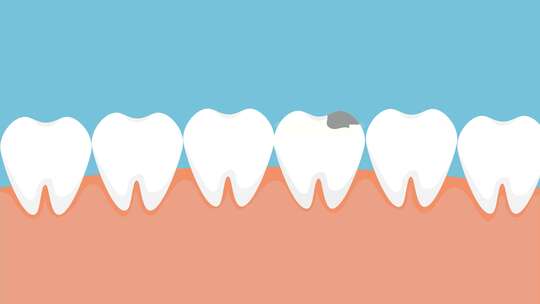 牙齿损坏变成蛀牙动画视频素材模板下载