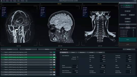 核磁共振图像扫描医疗软件界面