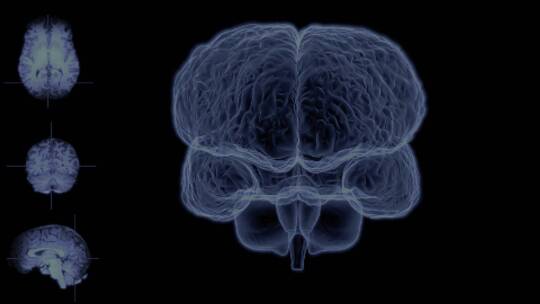 大脑扫描三维建模医疗科技生物监测
