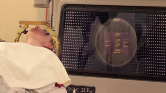 一名脑癌患者接受放射手术视频素材模板下载