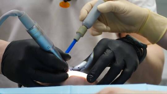 男性牙医治疗病人。口腔科做牙科手术视频素材模板下载