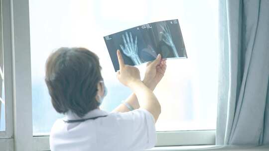 医生查看病人拍摄的CT片 询问病人视频素材模板下载