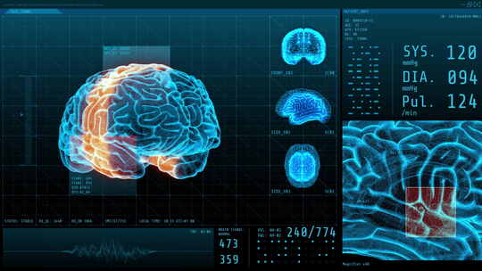 分析大脑组织结构的研究动画视频素材模板下载