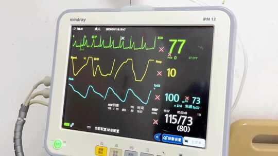 迈瑞iPM 12医疗监护仪画面