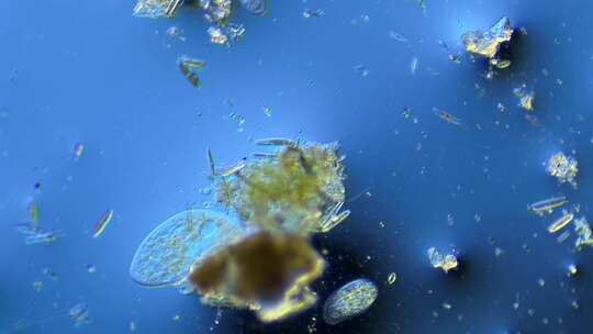 草履虫细菌纤毛虫硅藻等合集