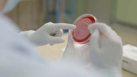 医生在实验室近距离观察培养皿红色微生物