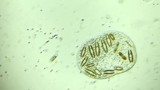 显微镜下吞噬很多硅藻的原生生物前口虫 放大400倍