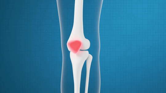 人体骨骼膝盖修复医学动画