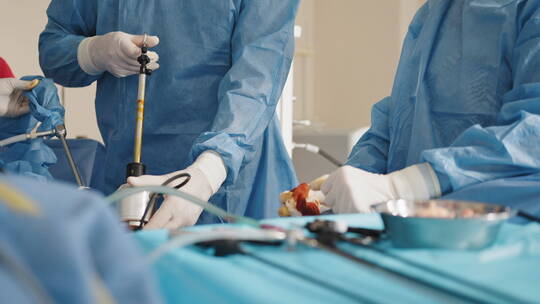 孕妇在医院进行剖腹产手术实拍素材
