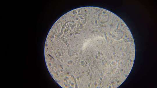 显微镜下精子运动2