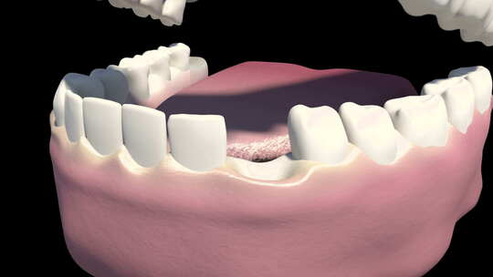 种植牙视频素材模板下载