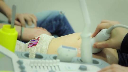 孕期超声检查视频素材模板下载