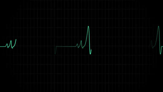 心电图浮动 带通道视频素材模板下载