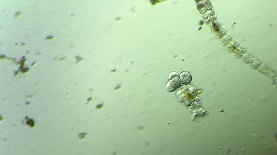 生命科学纪录片素材，显微镜下的生物，轮虫2