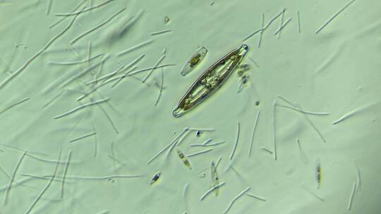 显微镜下的大量细菌与硅藻 放大400倍