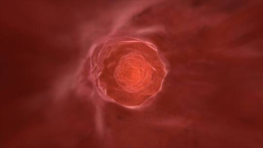 血管内部穿梭通道医疗科技血细胞红细胞
