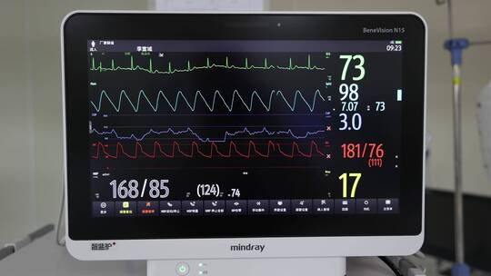 重症监护室ICU的呼吸机视频素材模板下载