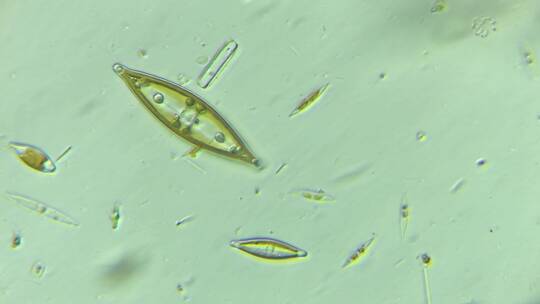 显微镜下的微观世界微生物 硅藻2