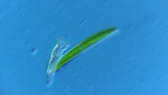 显微镜下的微观世界微生物 新月藻2