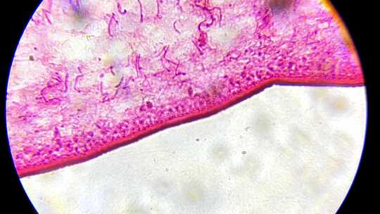 生物教材医学绦虫切片