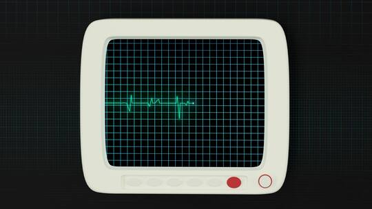 绿色屏幕上的心脏图曲线