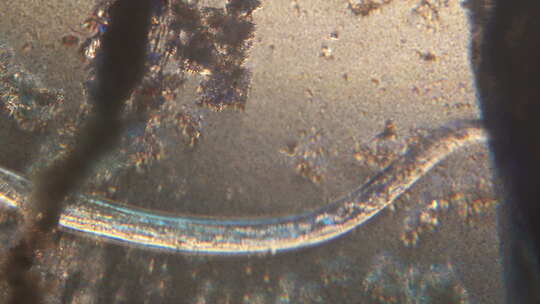 寄生虫线虫的显微镜