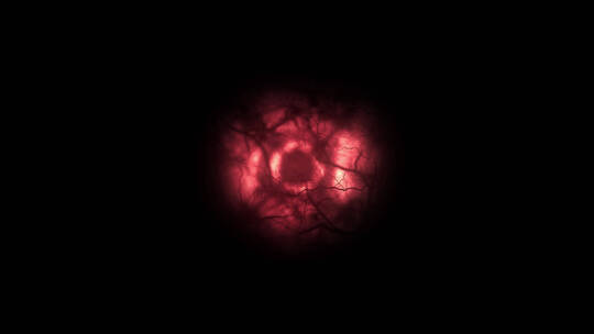 4k树状的血管红色球眼球 (2)