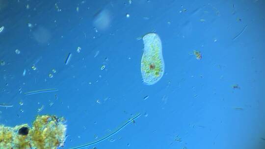 显微镜下的微观世界微生物 喇叭虫3