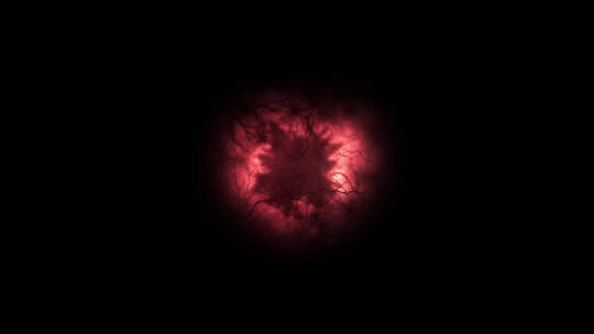 4k树状的血管红色球眼球 (3)
