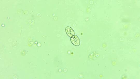 微生物纤毛虫细菌单细胞生物 2视频素材模板下载