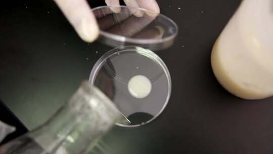 实验室检验采集细菌样本菌落培养皿