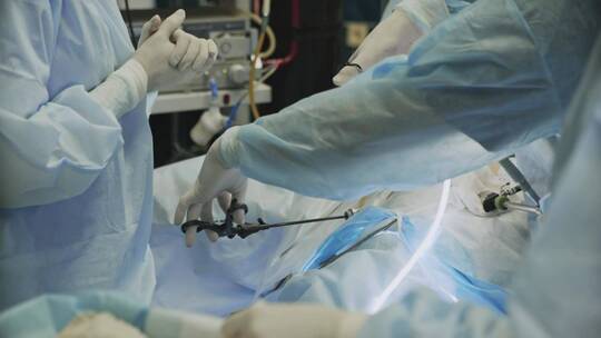 腹腔镜胆囊切除术意味着胆囊手术视频素材模板下载