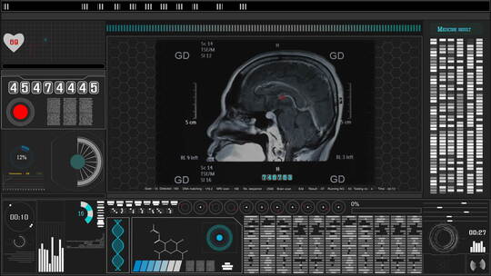 医学科技人类研究脑瘤患者画面