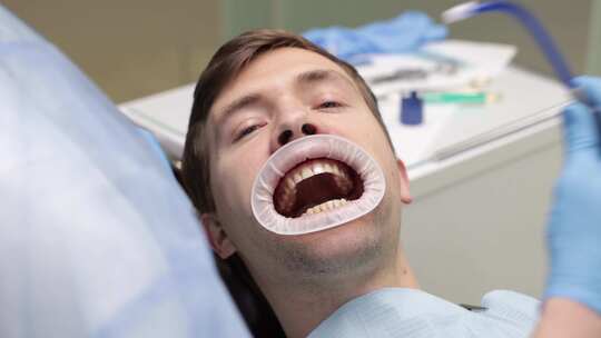 男人坐在牙科椅子上，嘴里有唾液喷射器，龋视频素材模板下载