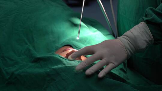 手术画面 鼻科手术1 4k 30fps视频素材模板下载