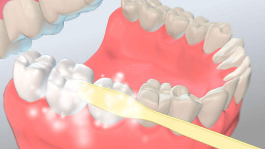 （带模型）三维牙齿刷牙工程ae模板AE视频素材教程下载