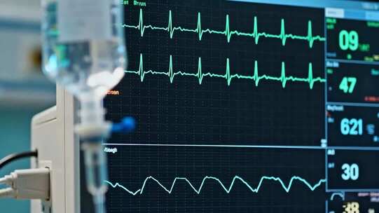 医院心电图监测设备画面