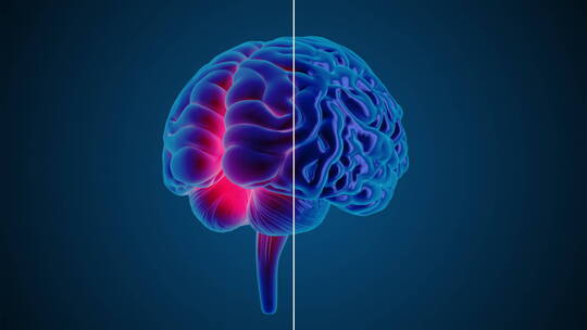 医学 大脑 脑科学 三维 脑ct1 模型