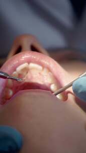 牙医给女性牙齿清洗口腔特写