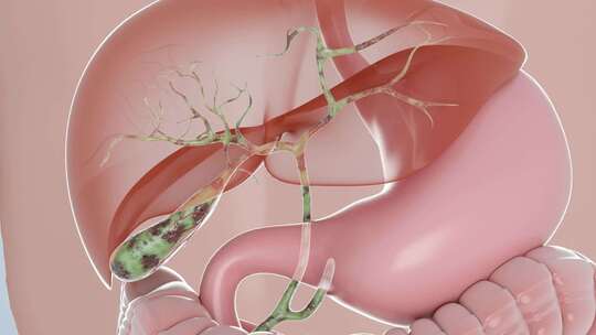 胆囊 胆囊炎 胆汁分泌 消化系统