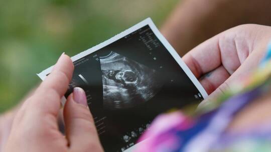 妇女手里拿婴儿的超声波图像