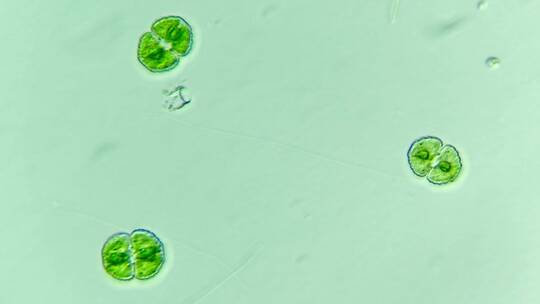 显微镜下放大400倍的鼓藻 2