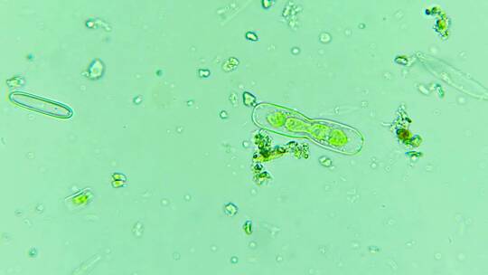 科研素材 微生物原生生物硅藻 2视频素材模板下载