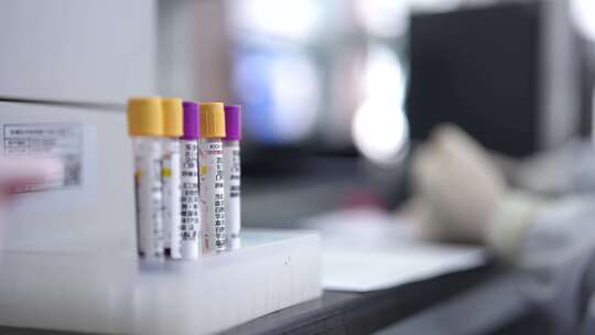 医院化验 验血实拍4K素材