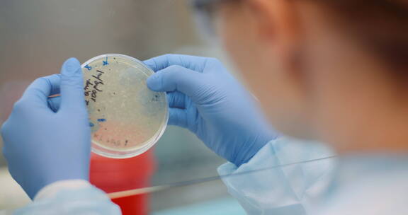 科学家在观察培养皿上的细菌
