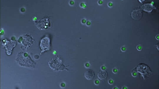 显微镜下白细胞吞噬细菌