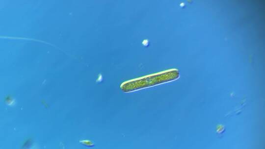 显微镜下的微观世界微生物 硅藻1